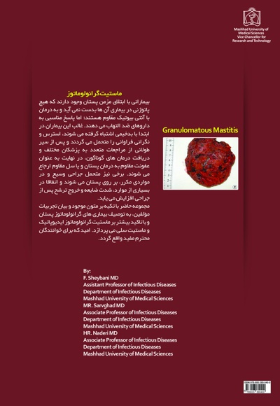 ماستیت گرانولوماتوز